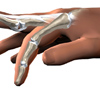 hand_finger_joint_symptoms01a